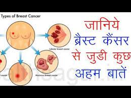 Cancer symptoms are changes in the body caused by the presence of cancer.they are usually caused by the effect of a cancer on the part of the body where it is growing, although the disease can cause more general symptoms such as weight loss or tiredness. Breast Cancer Symptoms And Treatment In Hindi Youtube