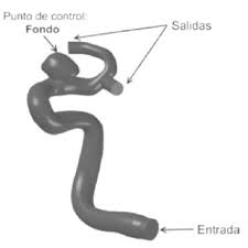 The next most common sites of cerebral aneurysm occurrence are in the internal carotid artery. Modelo Cad De Aneurisma Cerebral Real Donde U G Es La Velocidad De Download Scientific Diagram