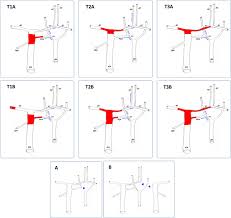 Cari teman baru lewat fitur cari jodoh, cari mutual dan sambung kata. Acute Occlusion Of The Distal Internal Carotid Artery Springerlink