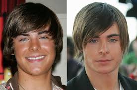 I opted for surgery so i can come back stronger than ever. World Celebrity Zac Efron Pictures