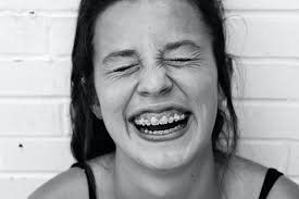 Here are some ways to get a better smile! How To Fix A Gummy Smile Uk
