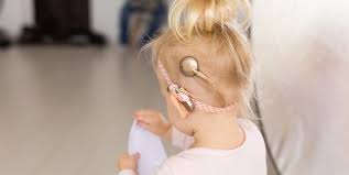 Image result for Cochlear Implant
