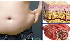 Resultado de imagen para imagenes de personas con gran abdomen