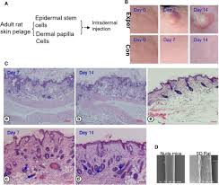 Atlas of hair pathology with clinical correlations. Preliminary Studies Of Hair Follicle Regeneration By Injections Of Epidermal Stem Cells And Dermal Papilla Cells Into Nude Mice Springerlink
