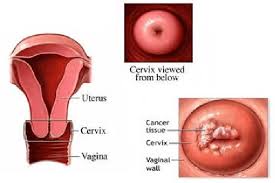Image result for cervix position