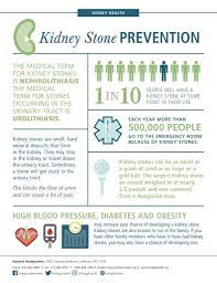 Kidney Stones – Cause, Symptoms, And Treatment - Urology Centers Of Alabama  | Urology Centers Of Alabama
