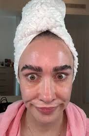 Mum now has eyebrows so long she can braid them after transplant