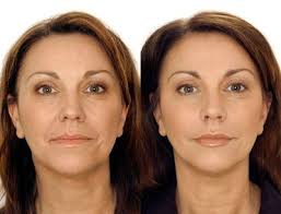 Crystal Obi (lilkizzy2009)