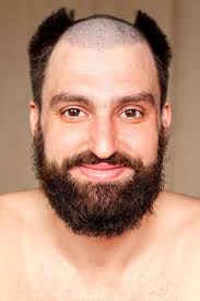 What Is A Reverse Mohawk