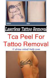 Can You Still See A Tattoo After Laser Removal Ankle Tattoo Removal Laseraway Tattoo Removal Prices Tattoo Removal 8010610590 Tattooremovalathome