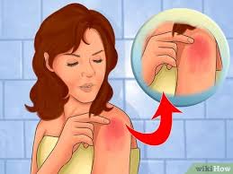 If you need to take an otc med before then, make sure it doesn't contain acetaminophen 1 view entire discussion (3 comments) 3 Ways To Take Dayquil Wikihow