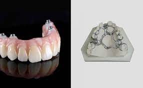 This is typically a temporary solution but some use them for longer. Flippers Dentures Vs Dental Implants What Are The Differences