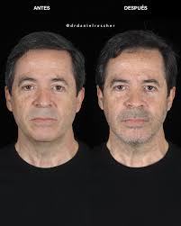 Daniel Roscher Ortognática Maxilofacial