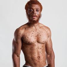 Obviouslyoutstanding Redhead Men People With Red Hair Beautiful Freckles