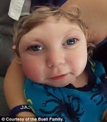 Toddler with brain malformation outlives expectations