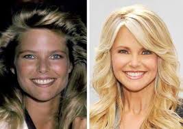 She's the content strategist of. See The Christie Brinkley Plastic Surgery Christie Brinkley Plastic Surgery Before After Christie Brinkley Plastic Surgery Plastic Surgery Christie Brinkley