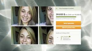 Die größte gefahr sind die auftretenden selbstmordgedanken. Crystal Meth 20 Jahrige Kratzt Sich Die Augen Aus Stern De