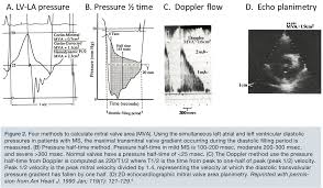 This restricts the flow of blood. A Brief Review Of Hemodynamics For Structural Interventions Part 2 Mitral Stenosis Cath Lab Digest