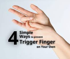 Image result for Trigger Finger