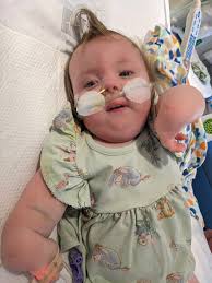 Fundraiser for Jeff Speegle by Lina Criddle : Baby Alyssa's fight against  Trisomy 18