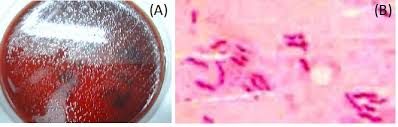 Don't delay your care at mayo clinic featured conditions helicobacter pylori (h. Functional Dyspepsia And Helicobacter Pylori Infection Intechopen