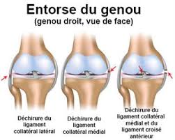 Ne perdez pas votre temps. Douleurs Du Genou Symptomes Traitement Definition Docteurclic Com