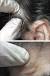 Hard Lump On Scalp