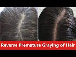 Your concerns are certainly worth it if you are still very young for grey hair. How To Reverse Premature Graying Of Hair Naturally Youtube Reverse Gray Hair Grey Hair Home Remedies Black And Grey Hair