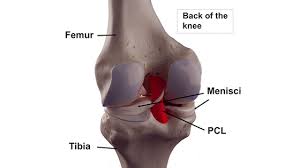 Image result for PCL Sulcus Test