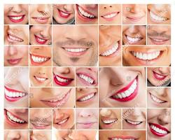 Image of person smiling with a healthy set of teeth