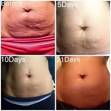 Pin On Coconut Oil Benefits