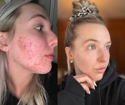 What's one skincare or beauty lesson that's changed the game for you in  2025?