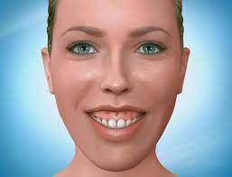 Sorry for the essay, i've got a lot on my mind about them and the appointment is on tuesday in i currently like my smile, i smile with only my upper teeth, its not gummy and i've been a few times that its nice. What Causes A Gummy Smile And How Can It Be Fixed Affordable Braces Jorgensen Orthodontics