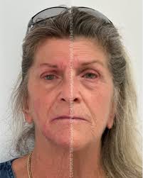 SÉRUMS DE VITAMINE C 🍊✨ Le sérum de Vitamine C peut vous aider à régler le  vieillissement précoce visible de la peau, la décoloration suite à l'été et  l'accumulation de rides et