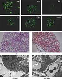 Frontiers | Potential Roles Of Oral Microbiota In The Pathogenesis Of  Immunoglobin A Nephropathy | Cellular And Infection Microbiology