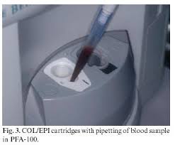 Image result for Platelet Function Closure Time