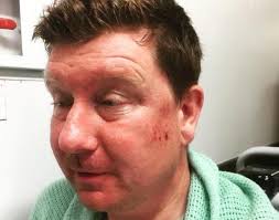 Renewed appeal after cyclist is seriously injured in Hawarden hit and run