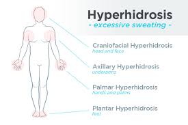 Many people experience sweaty feet occasionally. Excessive Sweating Archives Page 4 Of 5 Sweatblock