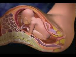 Cesarean Section How To Exercise After Having A Cesarean Section C Section Mommy Workout Plan Post C Section Exercise Mommy Workout