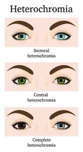 But i never really bothered to thoroughly look at the eyes. 45 Best Sectoral Heterochromia Images Stock Photos Vectors Adobe Stock