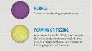 We did not find results for: Ini Dia 4 Hal Tentang Warna Air Kencing Yang Perlu Kamu Ketahui Ngonoo