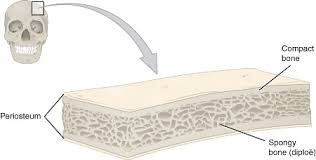 A bone is a rigid tissue that constitutes part of the vertebrate skeleton in animals. Compact Vs Spongy Bones Difference Between