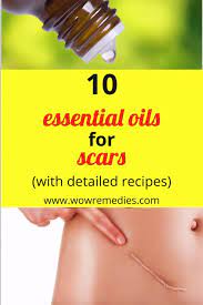 Pin On Howtocureyou