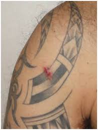Band tattoos neue tattoos mom tattoos future tattoos tatoos. Tattoo Preservation During Surgical Procedures Oas