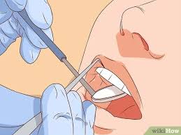 Teeth typically become loose when you have gum disease, which needs to be assessed by a professional. How To Fix A Loose Tooth 11 Steps With Pictures Wikihow