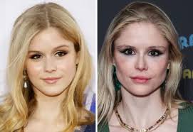 Erin Moriarty Plastic Surgery: Is That Why She Looks Different?