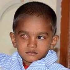 Anything that can increase your risk of getting a disease is called a risk factor. 3 Year Old Boy S Fight Against Rare Eye Cancer