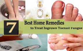 Certainly clearing nasal passages is the most widely appreciated use of vick's vaporub, but here are some unconventional ideas that preppers in particular will appreciate: 7 Best Home Remedies For Toenail Fungus Treatment