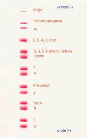 Hemoglobin Electrophoresis An Overview Sciencedirect Topics