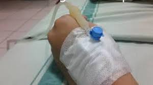Tangan Di Infus Youtube